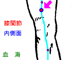 血海